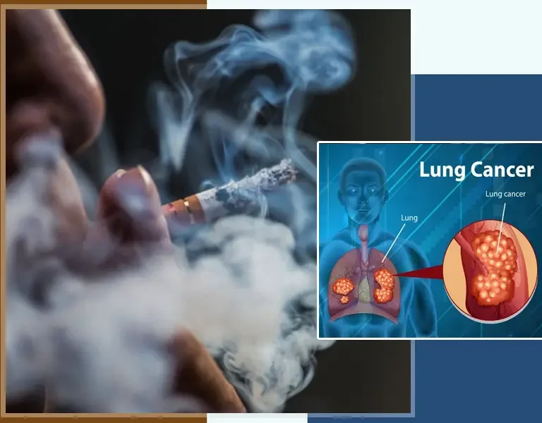 Can Tobacco Cause Lung Cancer? Oncologist Explains Risk Factors, Symptoms & Prevention Tips